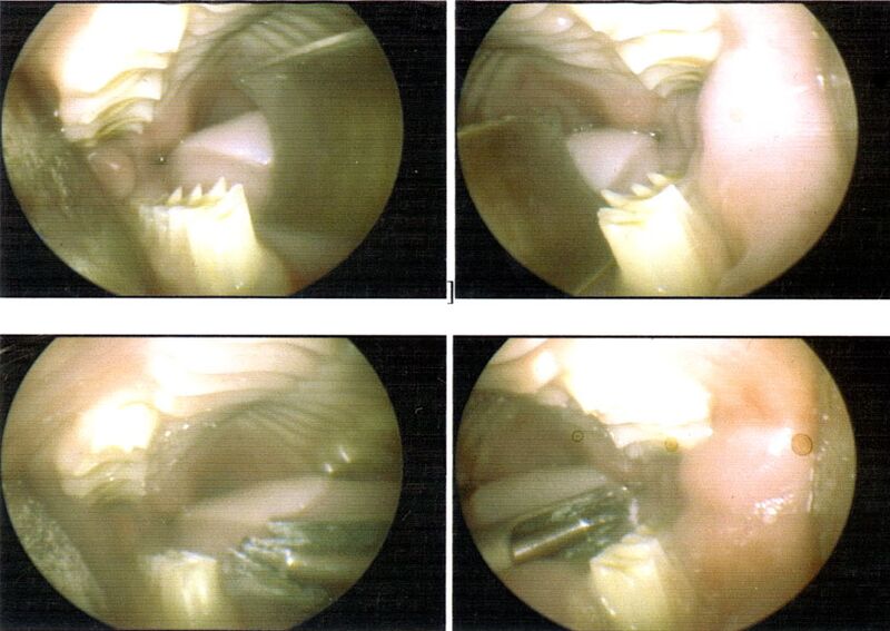 File:Whuffle molarspurs 2006.jpg